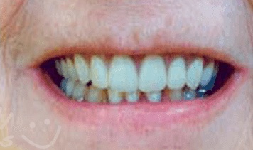 smile gallery image