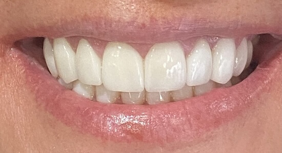 After