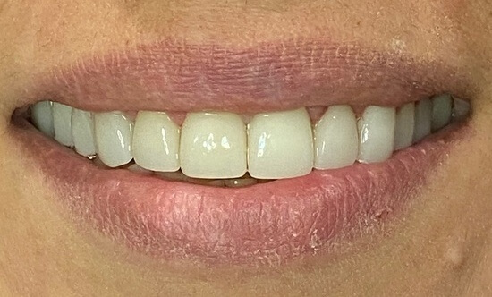 After