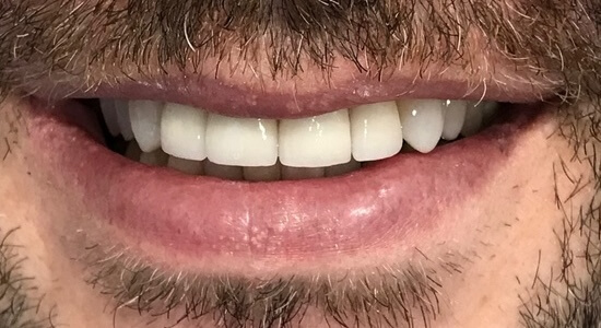 After