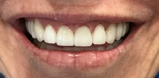 After
