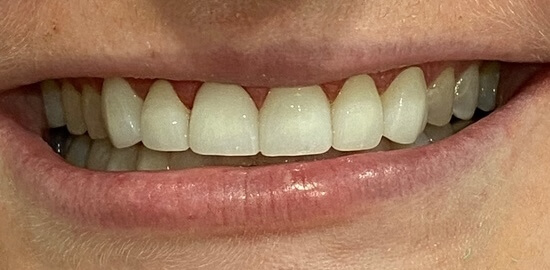 After