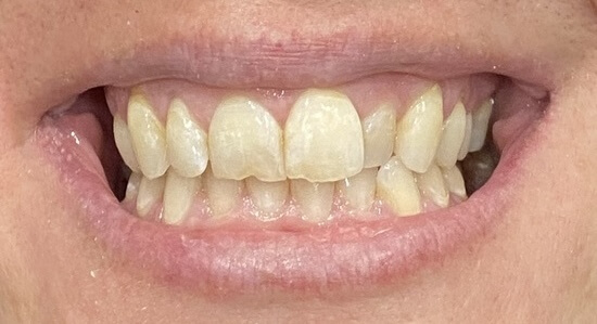 Before