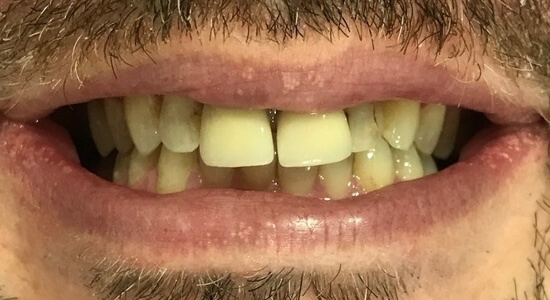 Before