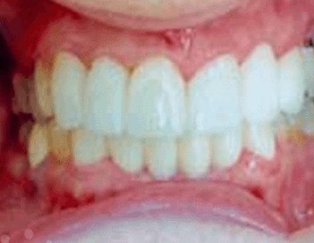 dentalbridgesafter dentalbridgesafter